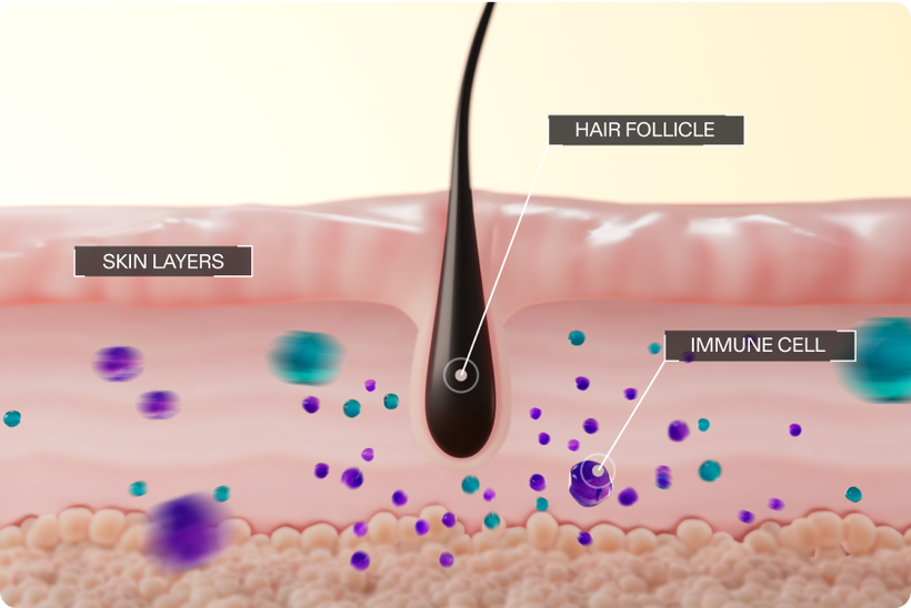 Unlocking Hair Regrowth: How Litfulo Revolutionizes Alopecia Treatment and Boosts Confidence