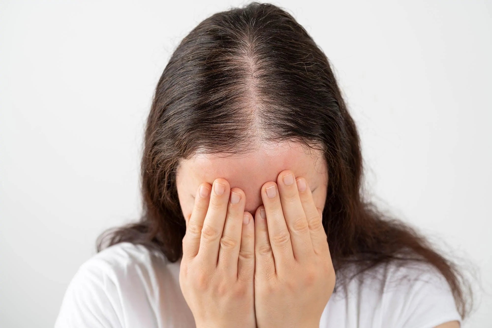 Menopause hair loss - How to treat it - Watermans